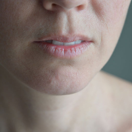 Labios Secos: Causas, Síntomas y Remedios Efectivos